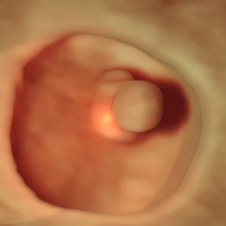 6-Weeks Embryo