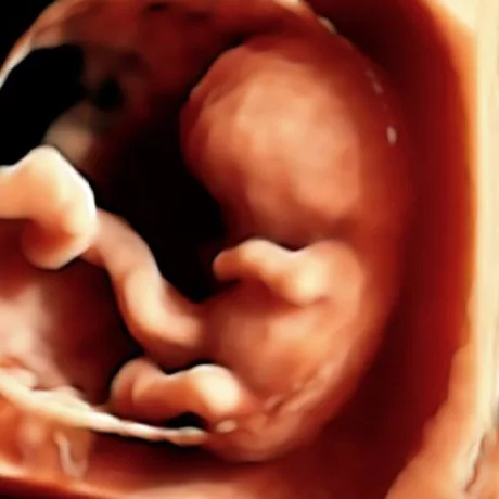 9-Weeks Embryo