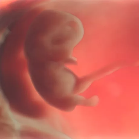 9-Weeks Embryo-2