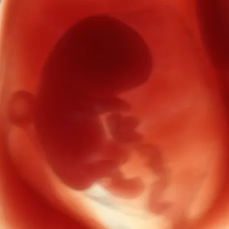 10-Weeks Embryo