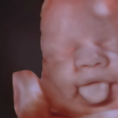 27-Weeks Embryo