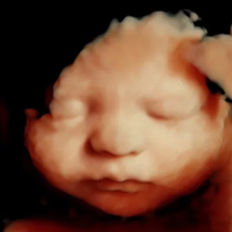 28-Weeks Embryo