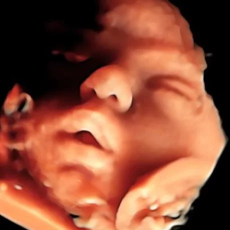 30-Weeks Embryo