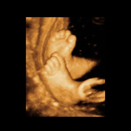 32-Weeks Embryo Feet