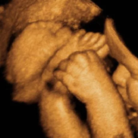 32-Weeks Embryo