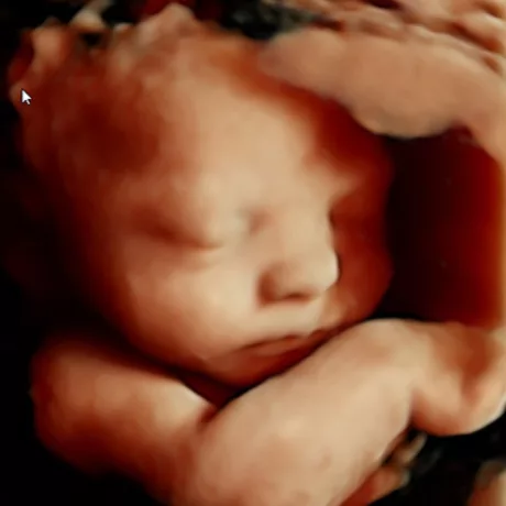 34-Weeks Embryo