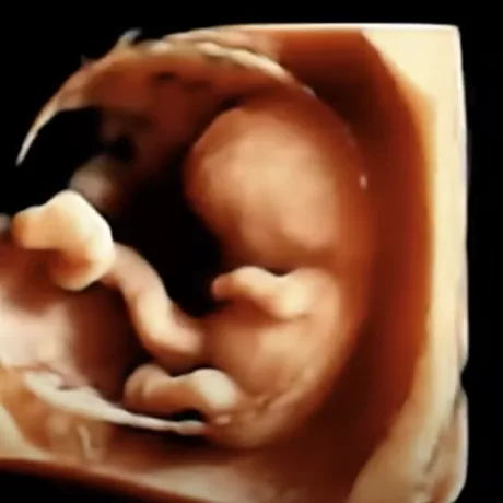 11-Weeks Embryo